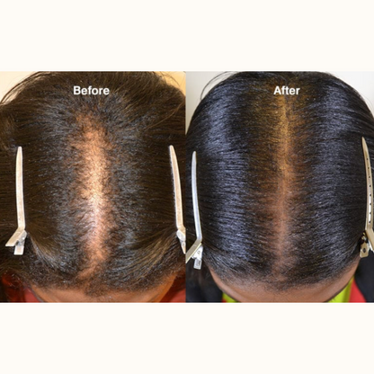 Batana Hair Growth Oil