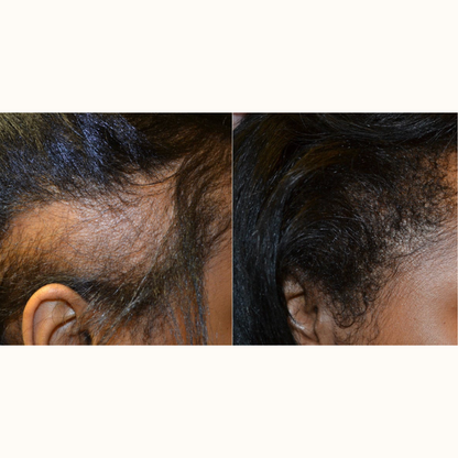 Batana Hair Growth Oil