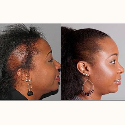 Batana Hair Growth Oil